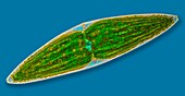 Closterium desmid, light micrograph