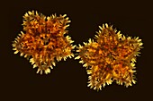 Pair of juvenile cushion stars, light micrograph