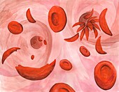 Sickle cells in blood vessel, illustration