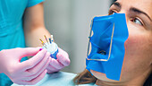 Endodontist setting barbed broach for endodontic treatment