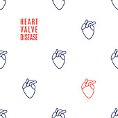 Heart valve disease, conceptual illustration