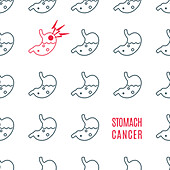 Stomach cancer, conceptual illustration