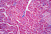 Hepatocyte cells, light micrograph