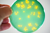 TCBS agar plate, light micrograph