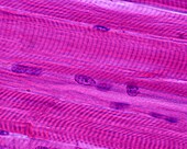 Muscle fibres, light micrograph