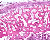 Embryonic bone diaphysis, light micrograph