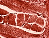 Tongue skeletal muscle fibres, light micrograph