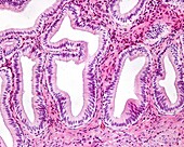 Gallbladder mucosa, light micrograph
