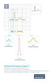 Normal ECG wave in lead II, illustration