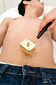 Moxibustion