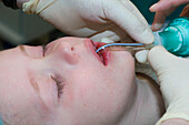 Intubating child for surgery