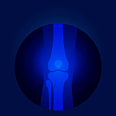 Knee X-ray, illustration