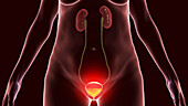 Cystitis, conceptual illustration