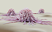 Cancer cells migrating, conceptual illustration