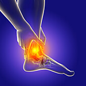 Painful ankle, illustration