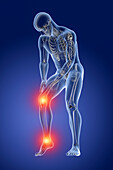 Foot and knee pain, illustration