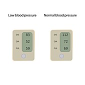 Normal and low blood pressure, illustration