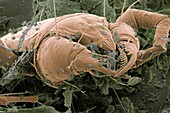Dermatophagoides mite in household dust
