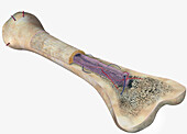 Bone structure, illustration