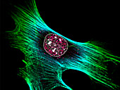 Fibroblast, fluorescent micrograph