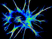Fibroblast actin heatmap, fluorescent micrograph
