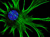 Fibroblast, fluorescent micrograph