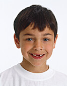 Boy with front teeth missing