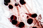 Aspergillus fungus, light micrograph