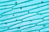 Plant cell, light micrograph