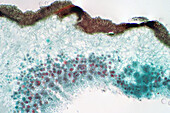 Lichen and fungi, light micrograph