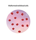 Malformed red blood cells, illustration
