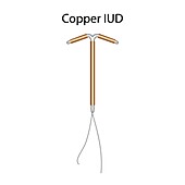 Copper intrauterine devices, illustration