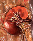 Healthy Kidney, Sectioned