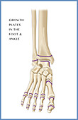 Foot Growth Plates, Illustration