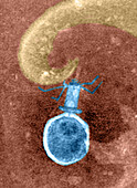T2 bacteriophage, TEM