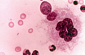 Megakaryocyte, LM