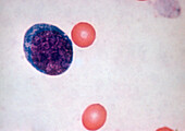 Primitive Stem Cell, LM