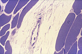 Post-Capillary Venule, LM