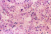 Liver, Haemopoietic Cells, LM