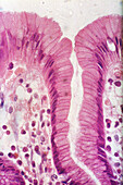 Gastric Surface Mucous Cells, LM
