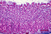 Stomach, Gastric Mucosa, LM