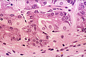 Gastric Enteroendocrine Cells, LM