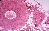 Artery and Smooth Muscle Cells, LM