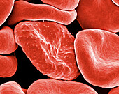 Malarial red blood cell, SEM