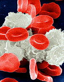 Red and white blood cells, SEM