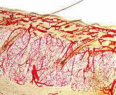 Human scalp, injected blood vessels, light micrograph