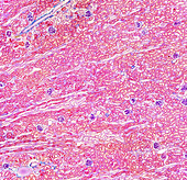 Kidney cortex section, light micrograph