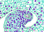 Lilium embryo sac, light micrograph