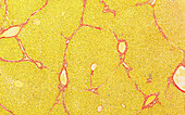 Liver lobules, light micrograph