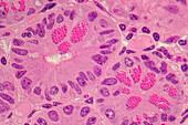 Duodenum, paneth cells, light micrograph